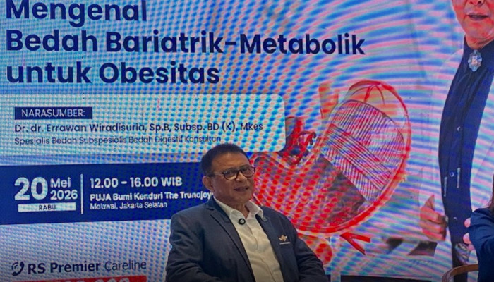 Bukan untuk Kosmetik, Bedah Bariatrik Pangkas Lambung 70 Persen demi Hilangkan Komorbid Obesitas